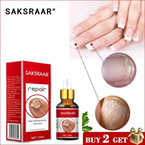 Nail Fungal Treatment Serum Onychomycosis Paronychia Anti-Fungal Nail Infection Herbal Toe Fungus Foot Repair Essence Care