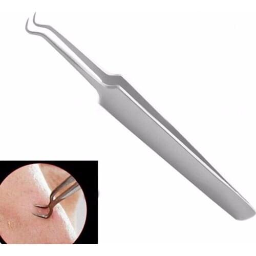 1PC Bend Curved Whitehead Blackhead Acne Clips Pimple Comedone Remover Face Cleaner Tool Beauty Products for Women Skin Care