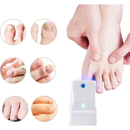 Fungal Nail Renewal Nail Laser Treatment Cure Onychomycosis Professional Toe Finger Nail Fungus Cleaning Machine