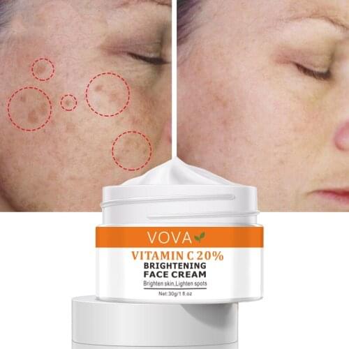 VOVA VC Whitening Freckles Cream Remove Freckles Dark Spots 30g Anti Freckle Cream Fade Pigmentation Face Skin Care TSLM1