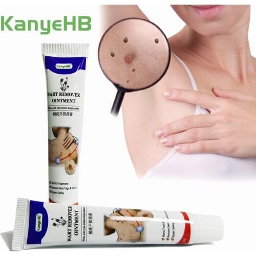 2pcs Skin Tag Remover Cream Wart Remover Ointment Apidly Treatment Remove Warts Mole Foot Corn Genital vulva Wart Ointment A634