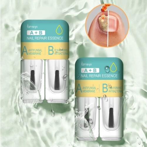 Biological repair film remove onychomycosis repair liquid correct onychomycosis liquid nail oil nail care fungus nail treatment