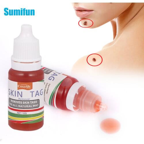 10ml Treatment Papillomas Removal of Warts Liquid kill Remover Foot Corn Skin Tag Mole & Genital Wart Remover Remedy Skin Care