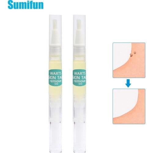 1Pcs 5 ml Skin Tag Pen Wart Liquid Against Genital Wart Flat Warts Painless Rapidly Removes Removal Papillomas Skin Care