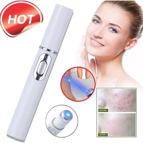 Durable Soft Scar Remover Acne Laser Varicose Veins Pen Portable Wrinkle Removal Machine US Blue Light Therapy Massager