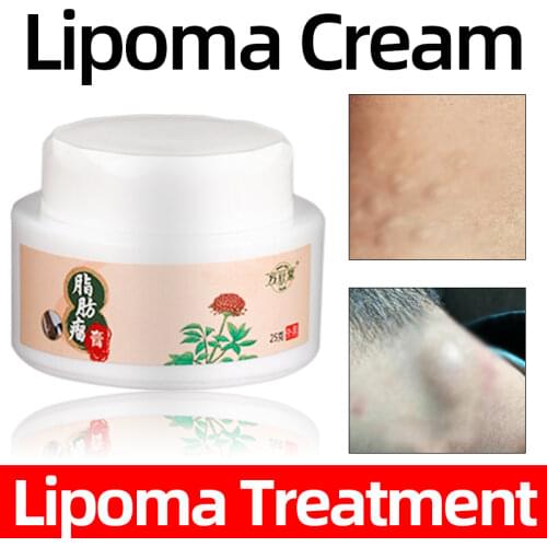 25g Fat Mass Lipoma Remove Cream Multiple Removal Subcutaneous lipoma Plaster Health Care Product