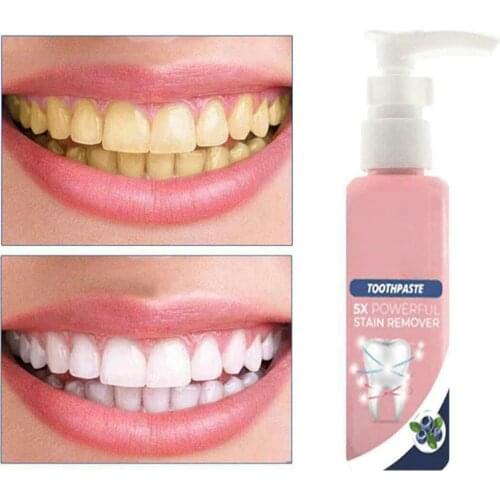 White Stain Removal Toothpaste Teeth Whitening Oral Stains Remove EF