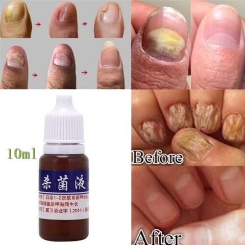 Nail Protector Skin Care Cream Nail Fungus Treatment Herb Nails Repair Cream Nail Care Tools High Quality hot