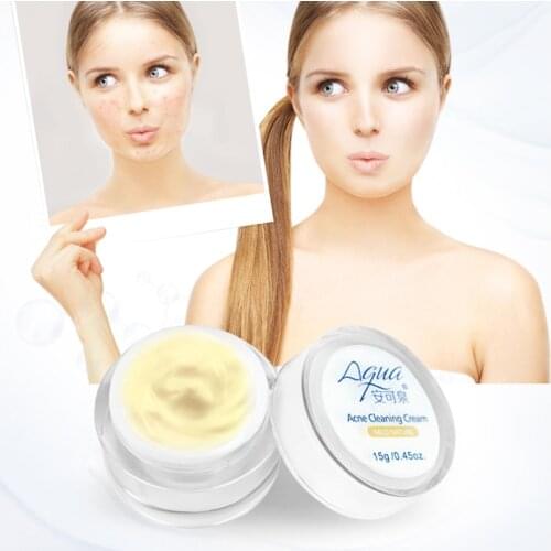 AUQUEST 15g Tea Seed Anti Acne Cream To Improve Pox and Pimple Acne Black Face Cream to Brighten Skin and Face Care Cosmetics