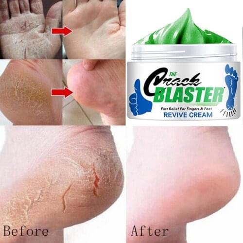 15g/ 30g/ 50g Cracked Heel Repair Cream Deeply Moisturize Soften Skin Dry Feet Treatment Rough Dry Feet Repair Cream for Repair