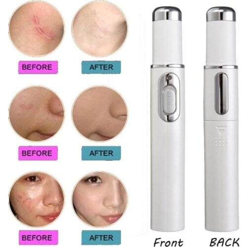 Blue Light Acne Laser Pen Portable Anti-Wrinkle Machine Durable Soft Scar Remover Device Laser Varicose Veins Therapy Treatment