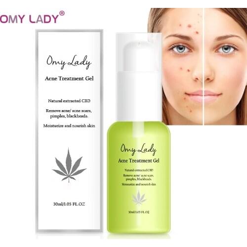 Acne Treatment Face Serum Blackhead Remove Anti Acne Cream Oil Control Shrink Pores Acne Scar Remove Skin Whitening