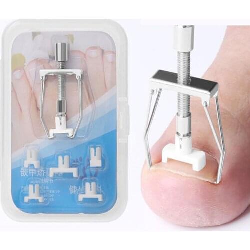 Ingrown toenails correction pedicure foot toe nail care tools Straightening Clip Brace corrector Wire Fixer
