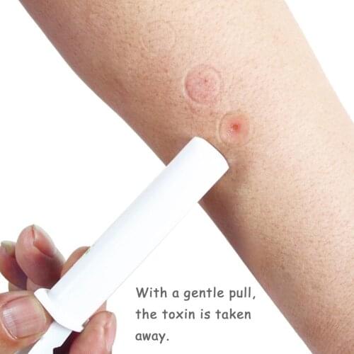 Mosquito Electric Extractor Pump First Aid Safety Kit Snake and Bug Bites Safety Emergency Photocatalytic Effective Extracto