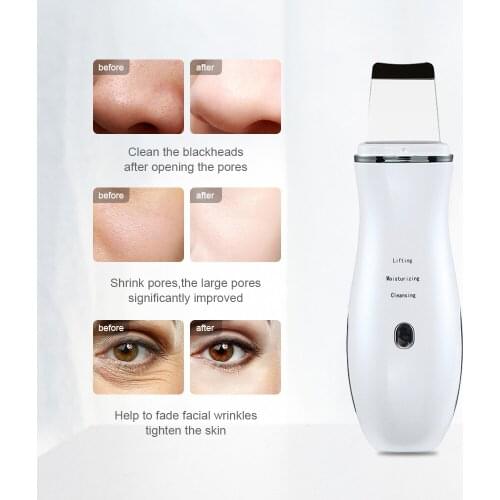 Ultrasonic Skin Scrubber Peeling Shovel Ion Acne Blackhead Remover Deep Cutin Cleaning Machine Face Lifting Facial Massager