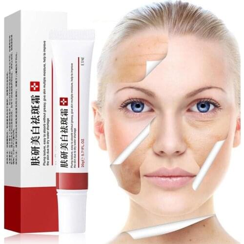 Acne Removal Cream Freckle Cream Shrink Pores Whitening Moisturizing Oil Control Acne Cream Skin Care Acne Treatment Face Cream