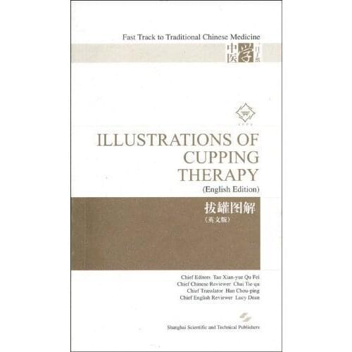 Illustrations of Cupping Therapy by Tao Xianyue,English,2009 [Paperback]