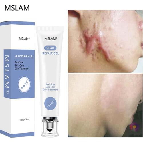 MSLAM 