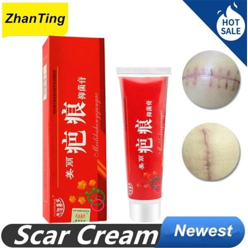 Scar Cream Stretch Marks Surgical Acne Scars Gel Scar Burn Pigmentation Repair Whitening Care Scar Cream