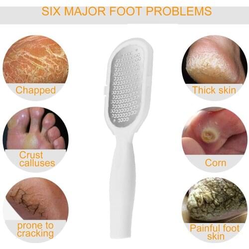 Home Callus Remover Foot File Foot Rasp And Professional Foot Scrubber Pedicure Tool Surgical Grade Stainless Steel File
