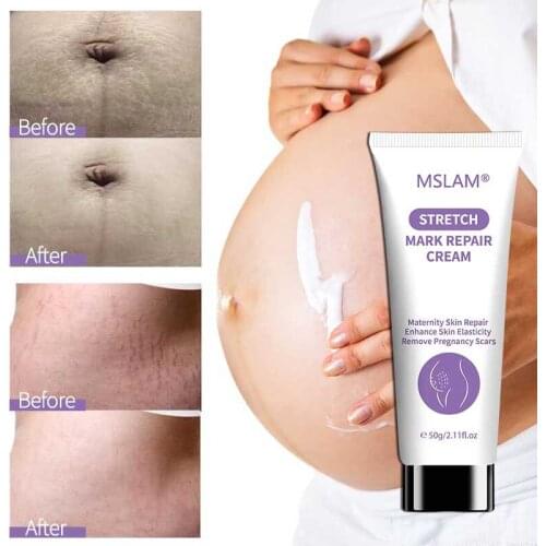 MSLAM Stretch Mark Cream Smooth Maternal Skin Repair Body Cream Removes Postpartum Scar Care Gentle Moisturizing 50g