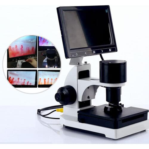 Nailfold Capillary Microcirculation Detector Digital Microscope Blood Microcirculation Instrument LCD Display Optional