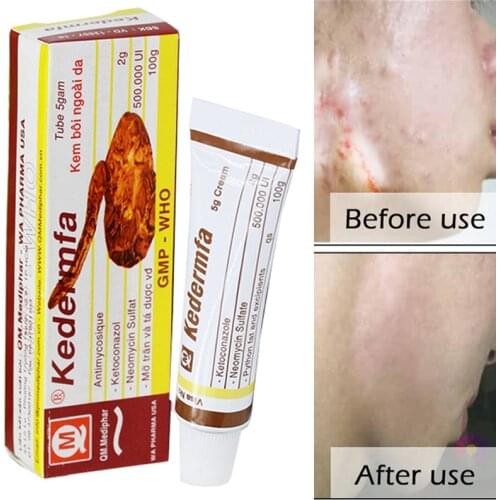Vietnam Remove Scar Cream Remove Acne Spots Remove Striae Gravidarum Pigmentation Corrector Anti-Aging Moisturizing 5ml