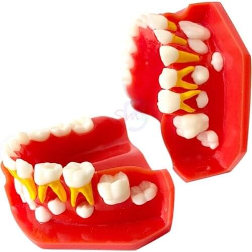 1pcs Dental Children Teeth Anatomical Model Dental Teaching Anatomy Model
