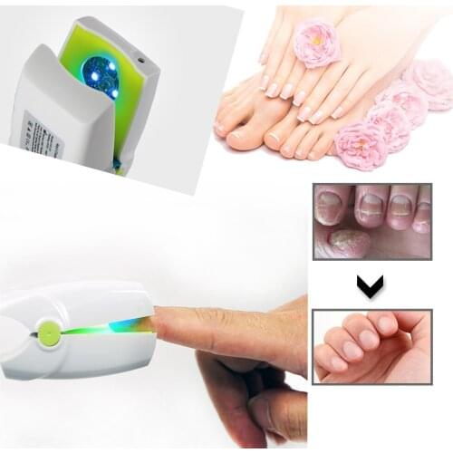 Toenail Fungus Light Therapy Treatment Device Cleaning Onychomycosis Fungal Infection lllt Cold Laser