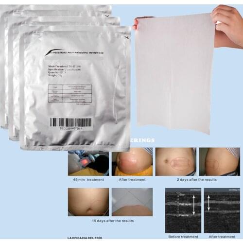 100% Effect New Arrival Lowest Price Anti freeze Membrane 27*30cm 34*42cm Antifreeze Membrane Cryo Pad for Cryolipolysis 10pcs