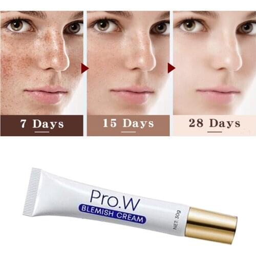 Pro.W Blemish Cream Freckles Acne Pimple Scar Dark Spots Removal Skin Whitening Clear And Skin Brightening Dropshipping 2020 NEW