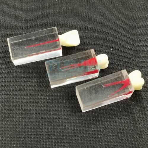 Dental Endodontic Tooth Model Root Canal Block For Students Training Dentist Technician Laboratory
