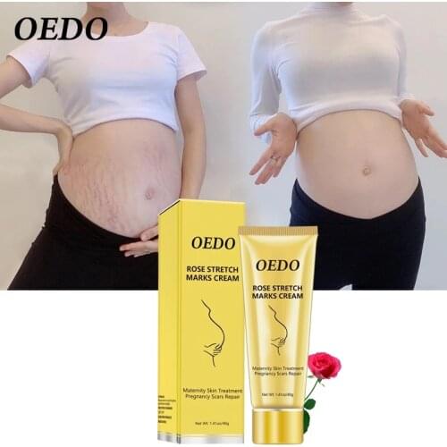 Rose Remove Stretch Marks Cream Anti Wrinkle Anti Aging Maternity Skin Repair Remove Pregnancy Scars Treatment Body Skin Care