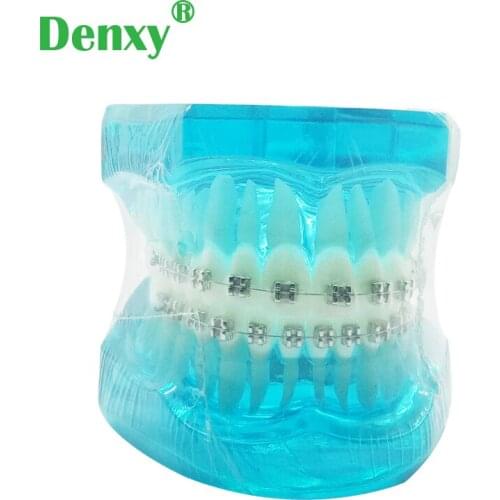Denxy 1pc Orthodontic model for Patient learn Tooth Brushing Instruction Model with Dental Brace Dentist Teach Dental tool
