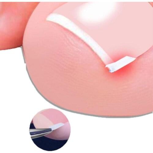 Paronychia Orthopedic Pad Nail Recover Tool Pedicure Fixer Toenail Care Nail Pedicure Foot L4E2