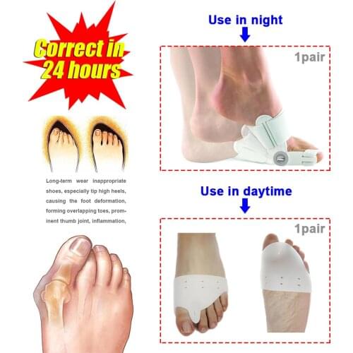 1set=1pair night use + 1pair daytime use) Toes Care Foot Thumb The Big Toe Separator Hallux Valgus Toes Support Toe Corrector