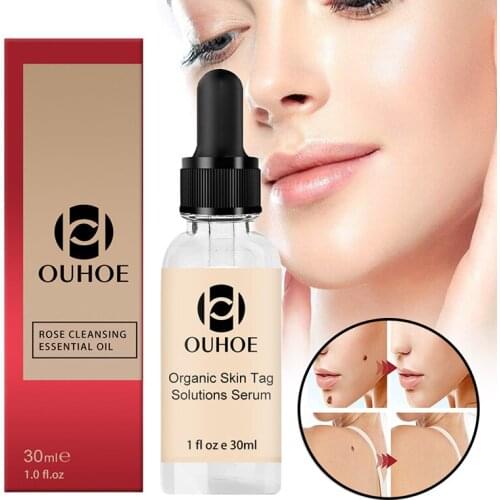 Portable Wart Removal Essential Oil Multipurpose Body Care Repair Cream Effective For Acne Moles Scar Wart Removal Essential Oil