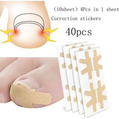 40pcs Toe Nail Care Corrector Patch Paronychia Treatment Pedicure Correction Stickers Ingrown Toenail Corrector Stickers