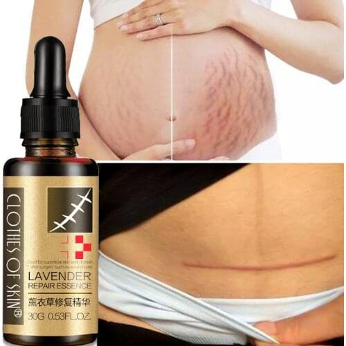 Stretch Marks Remover Essential Oil Skin Care Treatment Cream for Stretch Mark Removal Maternity Slackline for Pregnant Oils