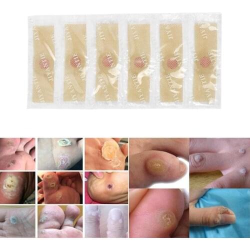 6pcs/lot Relieve Pressure Patch Foot Care Relief Pain Removal Warts Plaster Chicken Eye Corns Ointment Paste