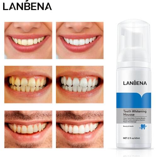 LANBENA Teeth Whitening Mousse Tooth Cleaning Remove Stains White Teeth Oral Hygiene Toothpaste Bleaching Whitening Dental Tool