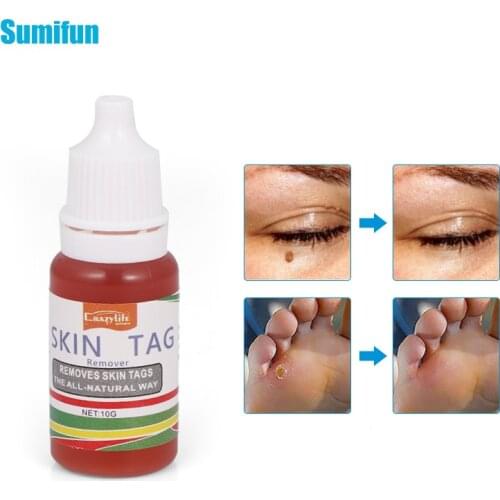 10ML Warts Remover Antibacterial Oli Wart Skin Tag Treatment Herbal Extract Corn Foot Corn Liquid Non-marking Organic Solutions