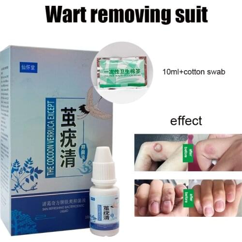 10ML Wart Anti-bacterial Liquid Wart Removal Spray Treatment Skin Tag Removal Anti-mole Remover Corn Wart Anti-Wart Remove