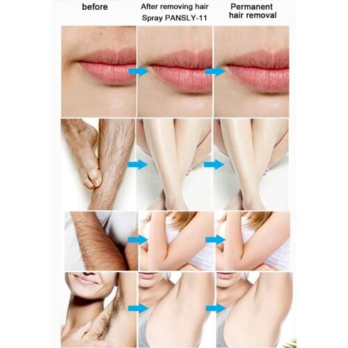 Hair Growth Inhibitor Spray Mist Permanent Beard Underarm Legs Stop Hair Growth Hair Growth Removal Inhibitor Spray