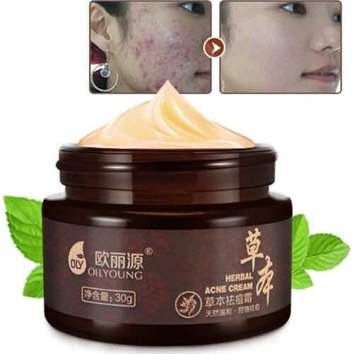 Herbal Acne Cream Anti Pimple Spot Acne Scars Blackhead Removal Cream Whitening Beauty Skin Face Care Creams Acne Treament