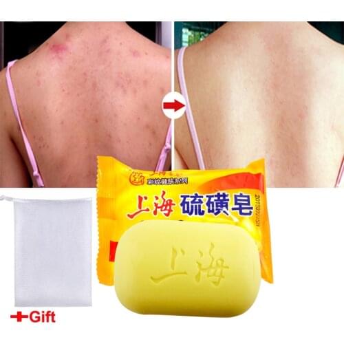 Sulfur soap oil-control acne treatment blackhead remover soap 85g Whitening cleanser Skin care