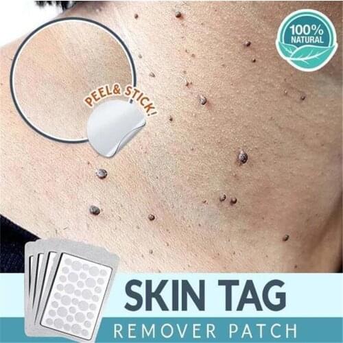 Skin Tag Remover Patch Ance Pimple Patch Plaster Acne Cream Hydrocolloid Master Anti-infection Quick Absorb Face Care