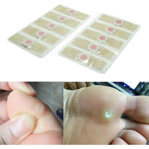 36pcs Medical plaster Foot Corn Removal Remover Warts Thorn Plaster Of Calluses Patch Callosity Detox Foot Pad Curative Plasters