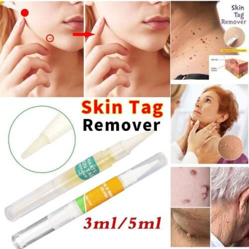 Body Warts Treatment Cream Skin Tag Remover Foot Corn Removal Plantar Genital Warts Ointment Foot Care Cream 3/5ML