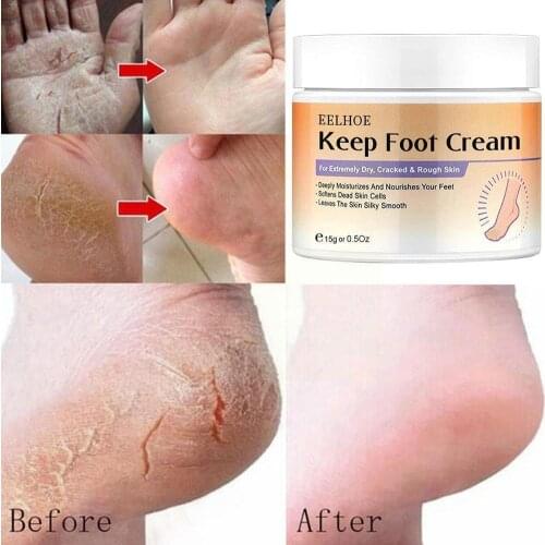 Anti-Drying Crack Foot Cream Heel Cracked Repair Cream Skin Dead Care Feet Cream Hand Removal P0K5